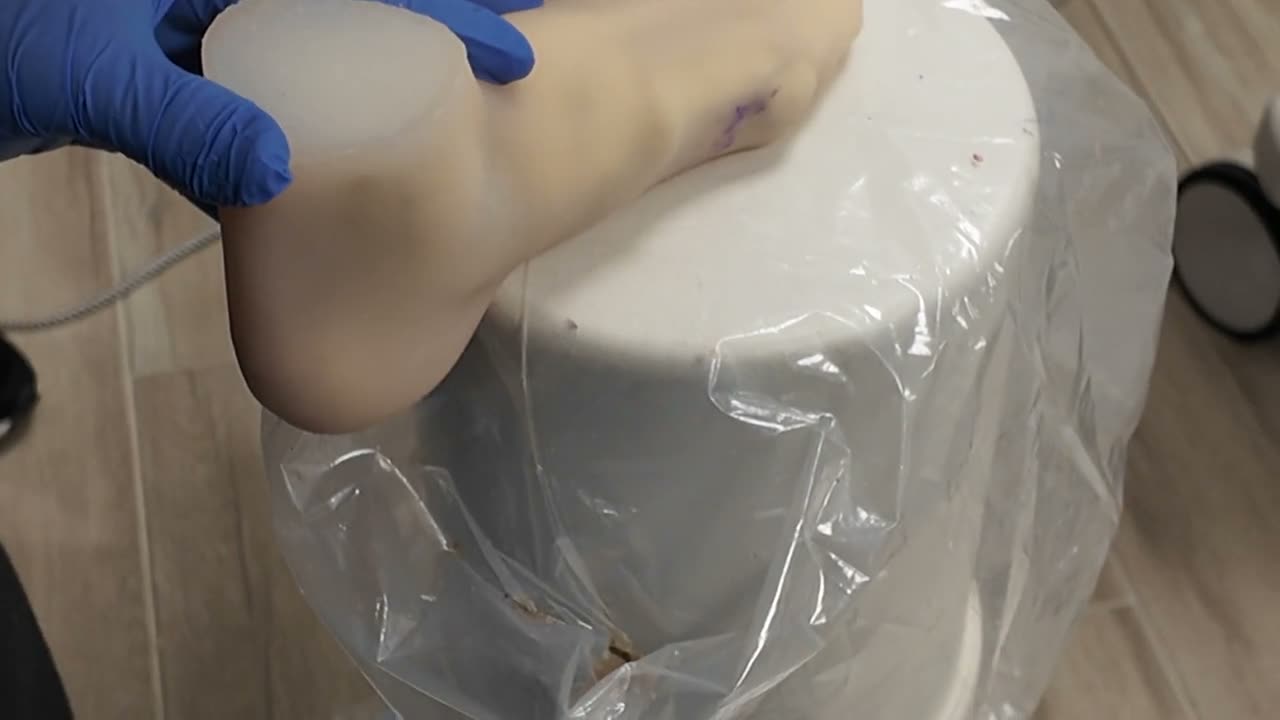 The Cadara Foot under a C-arm for live fluoroscopy
