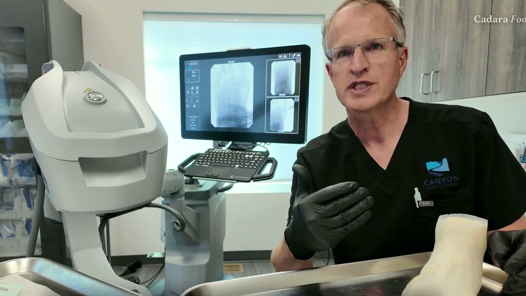 Dr. Cory Pilling at his own C-arm with the translucent Cadara Foot